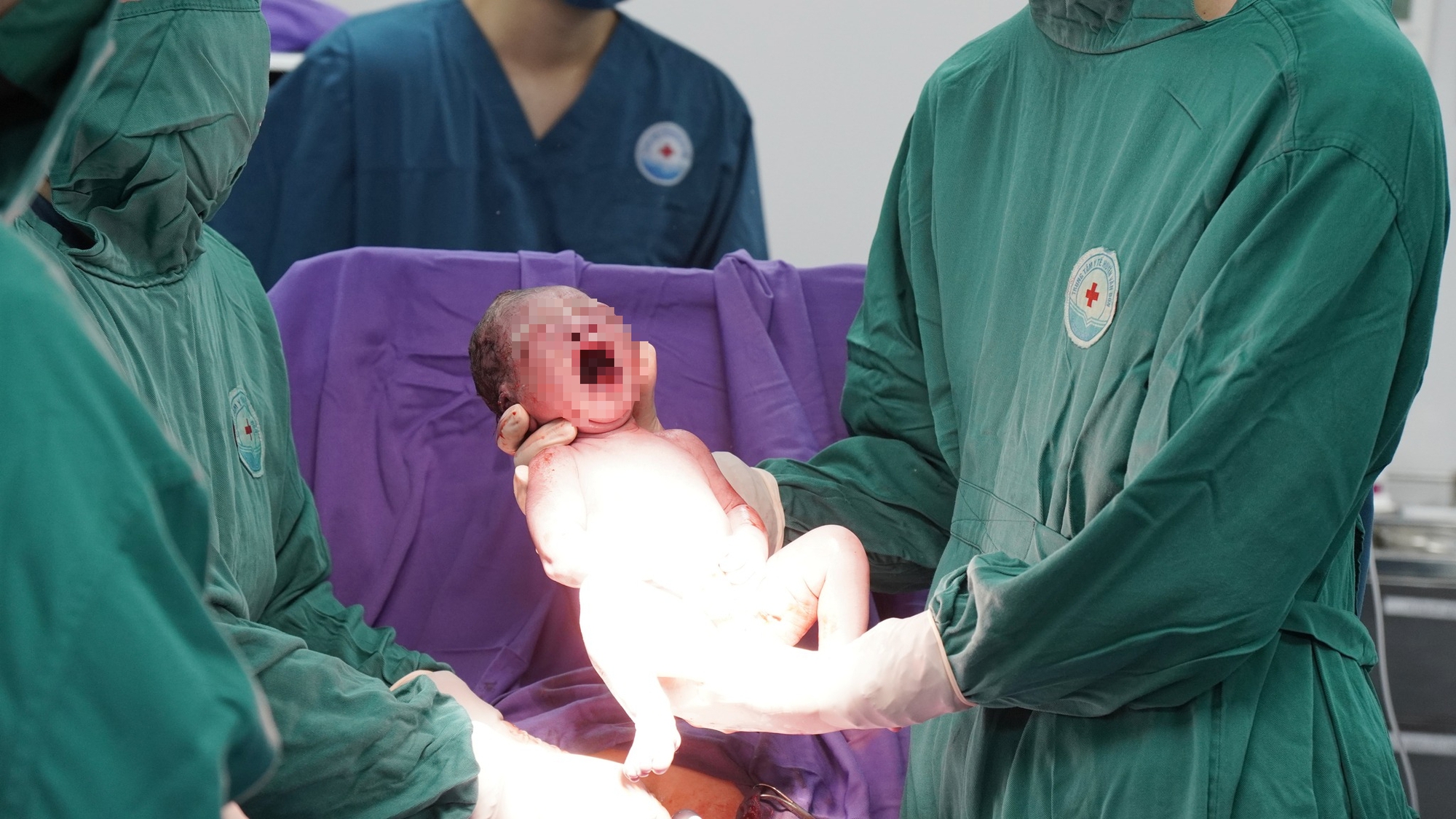 Bác sĩ xuyên đêm vượt sóng dữ, mưa dông cứu sản phụ khó sinh ở xã đảo- Ảnh 3.