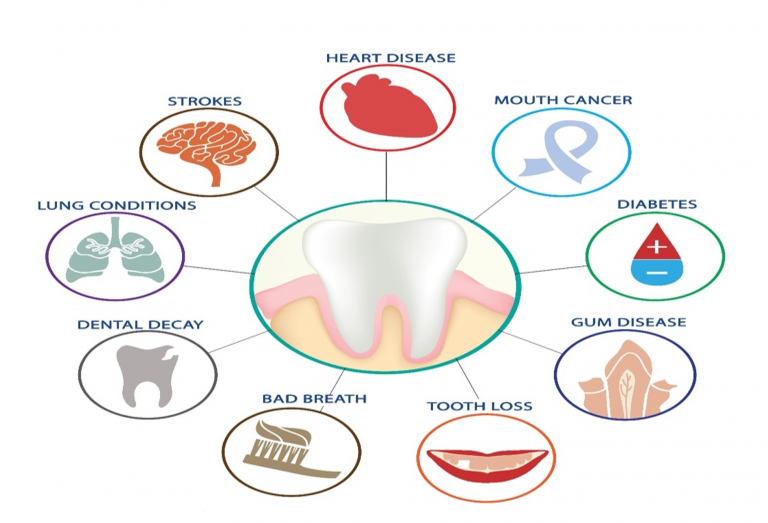 Có thể bạn chưa biết: Răng miệng khỏe - phòng bệnh toàn thân- Ảnh 1.