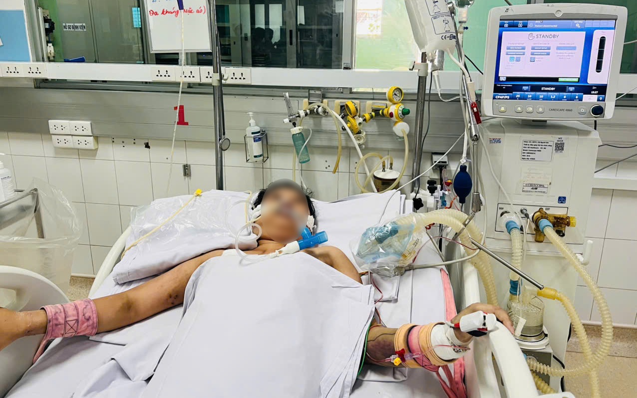 Sốt xuất huyết tấn công người trẻ khỏe ở TPHCM, 2 bệnh nhân suýt chết vì suy đa cơ quan