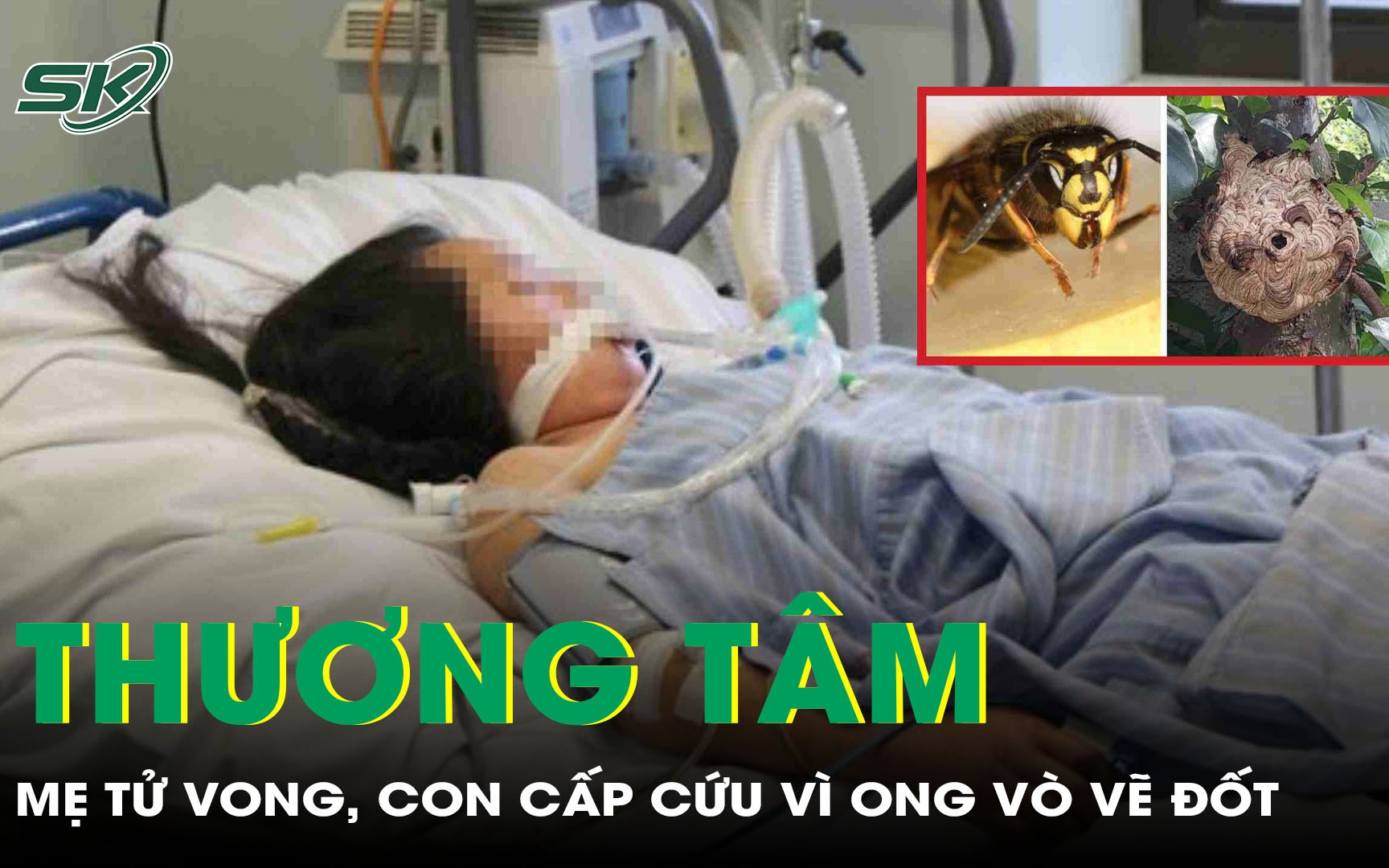 Thương tâm: Mẹ tử vong, con 3 tuổi cấp cứu vì ong vò vẽ đốt 