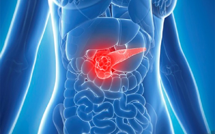 Phát hiện khối u đầu tụy nguy hiểm từ cú ngã tình cờ- Ảnh 2.