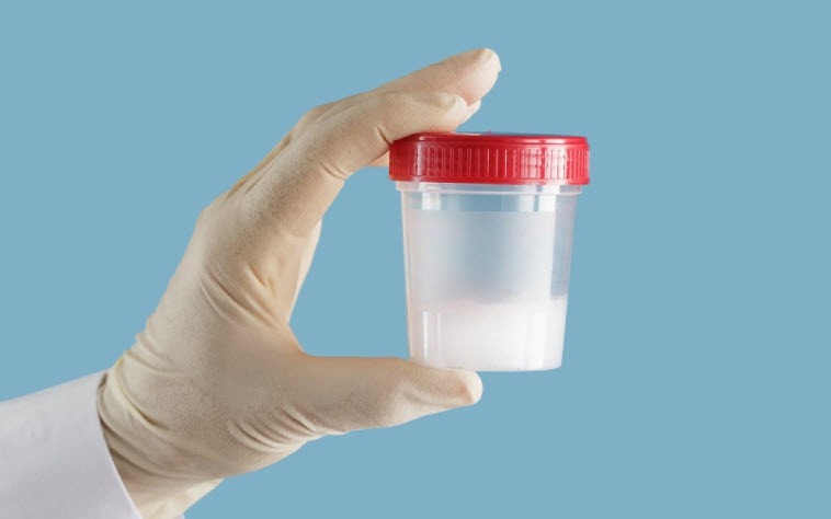 Ô nhiễm không khí âm thầm làm giảm chất lượng tinh trùng ở nam giới