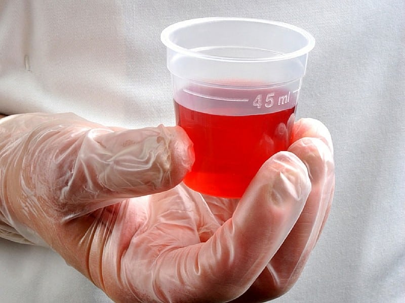 Những điều cần biết khi sử dụng methadon điều trị nghiện chất dạng thuốc phiện- Ảnh 1.