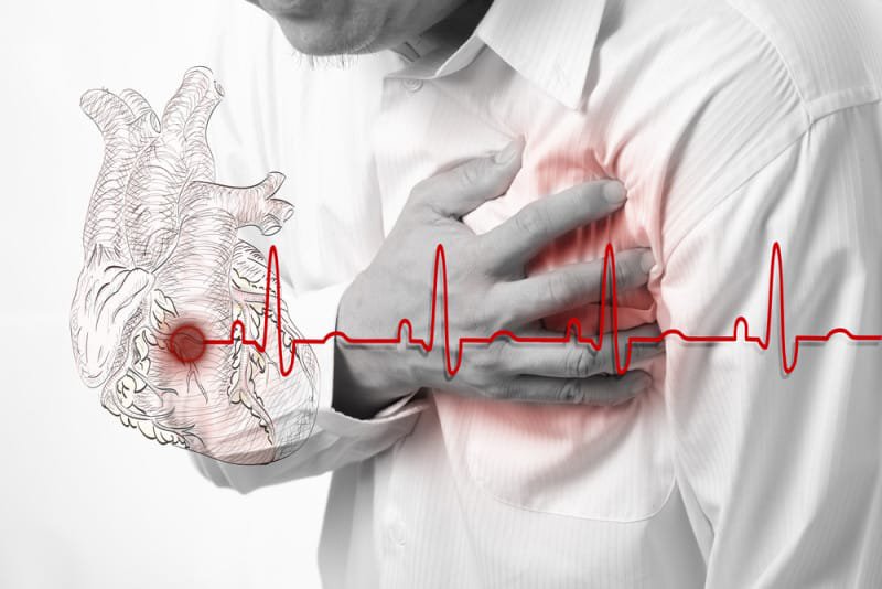 5 biểu hiện cho thấy bạn mắc suy tim- Ảnh 1.