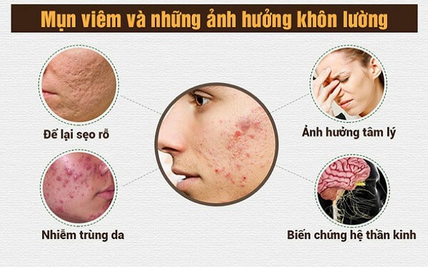 mun viem 17579871606101426931329 7 0 382 600 crop 17579872805961066243041