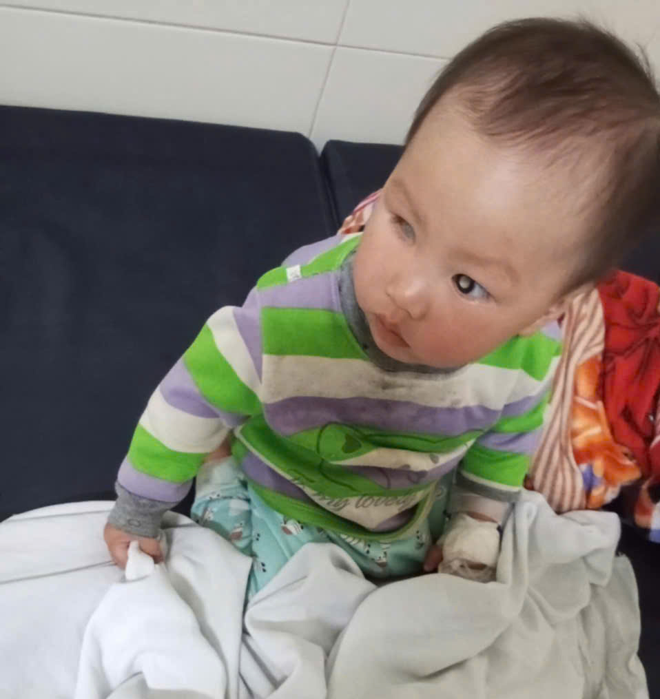 Sức khỏe của bé gái 2 tuổi bị ung thư võng mạc đã có những tiến triển mới- Ảnh 1. Sức khỏe của bé gái 2 tuổi bị ung thư võng mạc đã có những tiến triển mới- Ảnh 1.