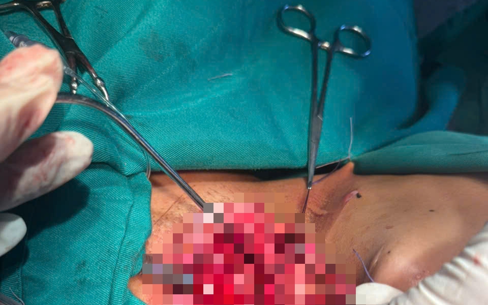 Nữ sinh bị dây điện quấn vào cổ trên đường đi học về- Ảnh 3.