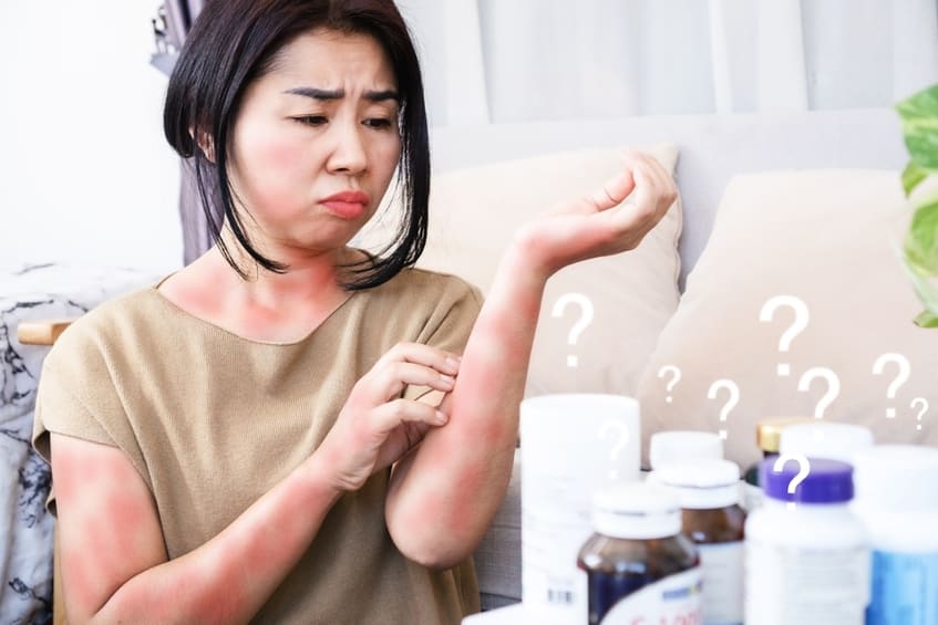 Hiểu tác dụng phụ của thuốc để phòng ngừa đúng cách- Ảnh 2.