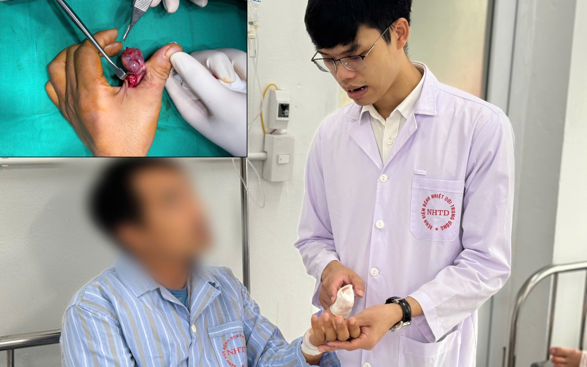 Cùng lúc bị 3 virus tấn công, bệnh nhân rơi vào nguy kịch- Ảnh 1.
