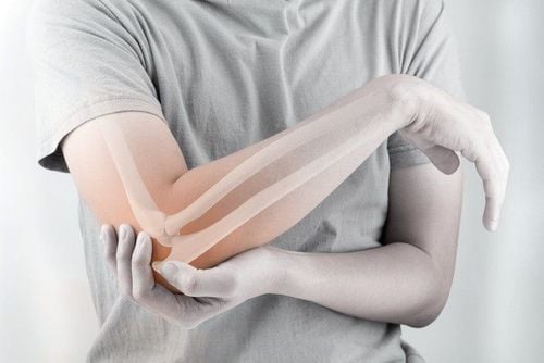 Loãng xương sớm - Dùng thuốc và phòng ngừa như thế nào?- Ảnh 3. Loãng xương sớm - Dùng thuốc và phòng ngừa như thế nào?- Ảnh 3.