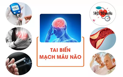 Tai biến mạch máu não: Nguyên nhân, triệu chứng và giải pháp phòng ngừa- Ảnh 1. Tai biến mạch máu não: Nguyên nhân, triệu chứng và giải pháp phòng ngừa- Ảnh 1.