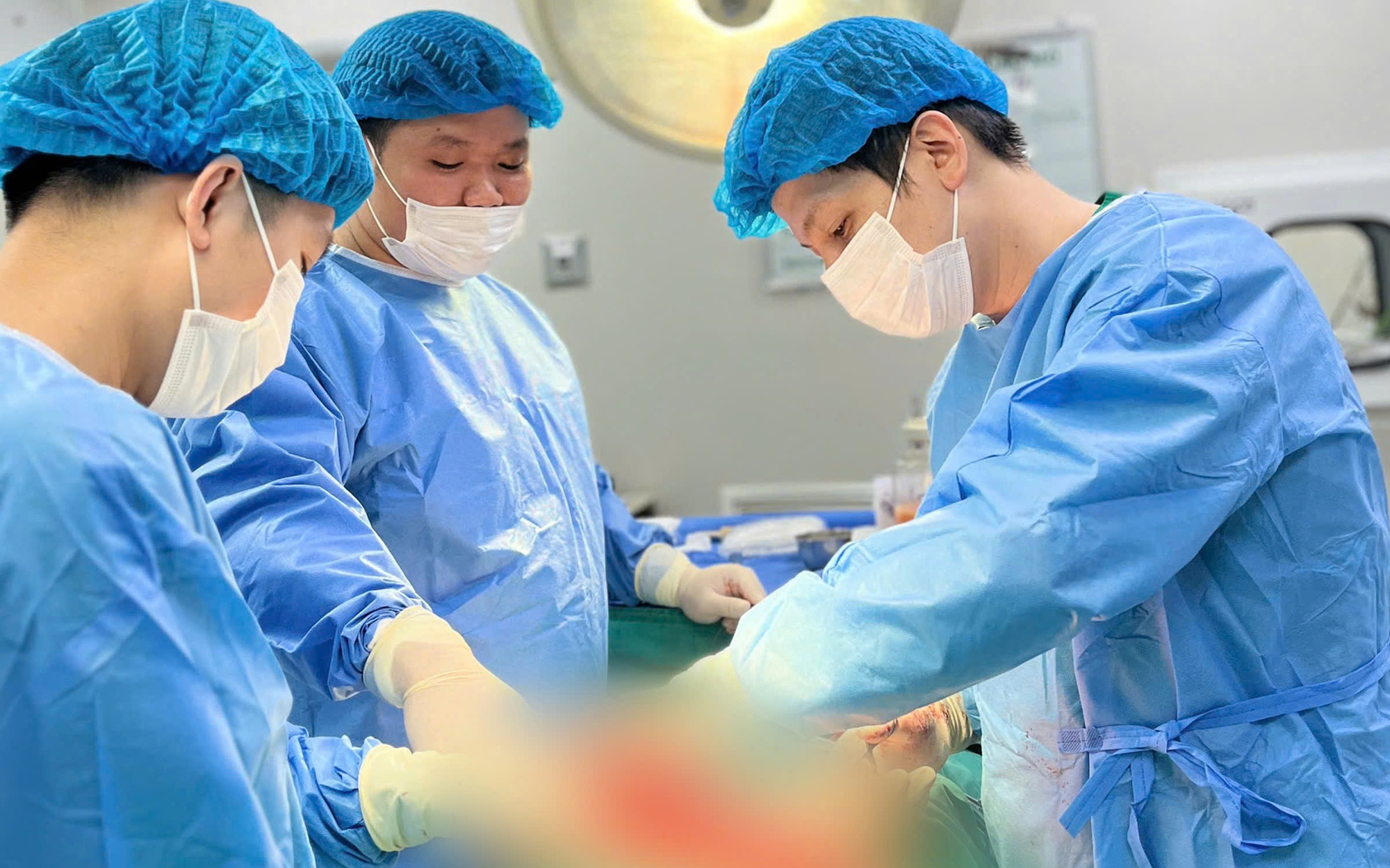 Sẹo rỗ có tự làm đầy được không?- Ảnh 2.