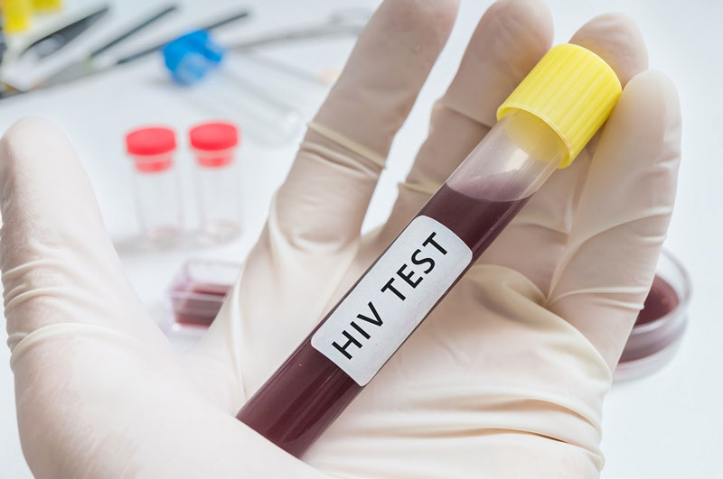 Trường hợp nào nên xét nghiệm HIV?