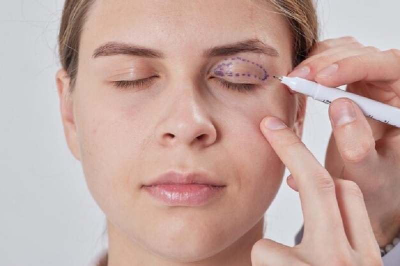 Nhận biết nhược cơ và biến chứng nguy hiểm- Ảnh 1. Nhận biết nhược cơ và biến chứng nguy hiểm- Ảnh 1.