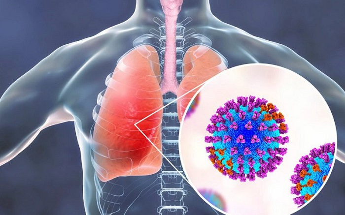 Viêm phổi do Adenovirus ở trẻ: Nhận biết sớm dấu hiệu nguy hiểm- Ảnh 3.