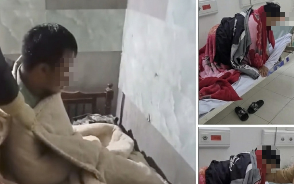 Một người tử vong nghi do bệnh dại sau 4 tháng bị chó cắn nhưng không tiêm phòng