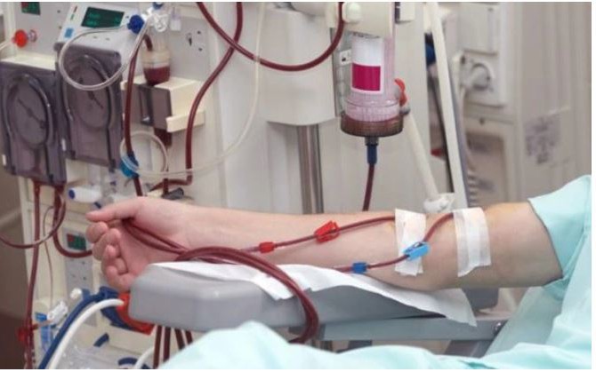 Đau lưng tưởng đơn giản, phát hiện ‘quả bom nổ chậm’ trong ổ bụng- Ảnh 3. Tầm soát sớm, điều trị kịp thời, giảm gánh nặng căn bệnh hơn 10 triệu người Việt đang mắc