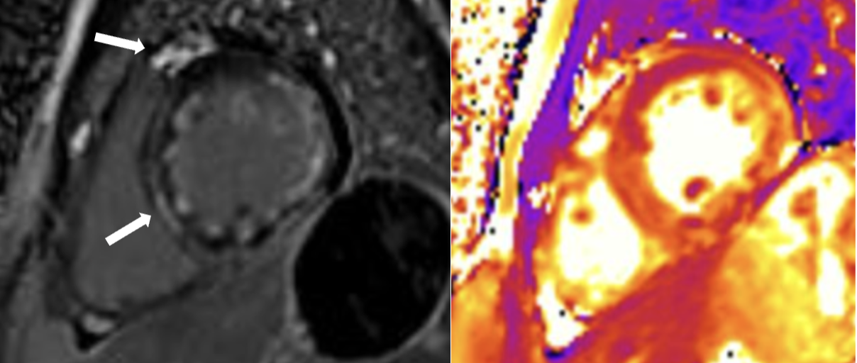 Đang chơi cầu lông, nam thanh niên 32 tuổi ngừng tim nguy kịch- Ảnh 2.