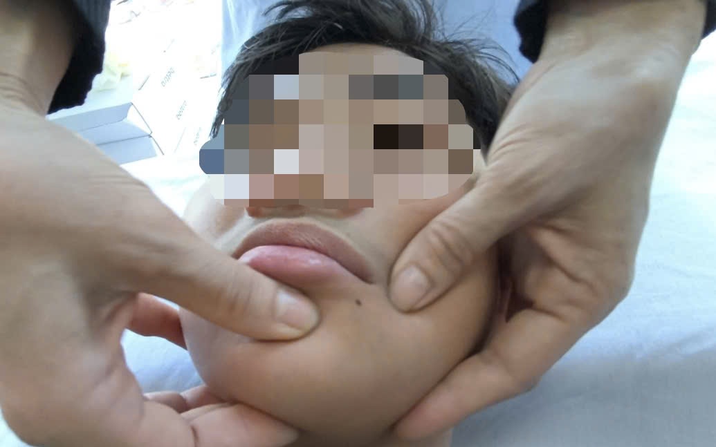 Người đàn ông khó thở, tím tái sau 2 ngày ăn cỗ- Ảnh 1.