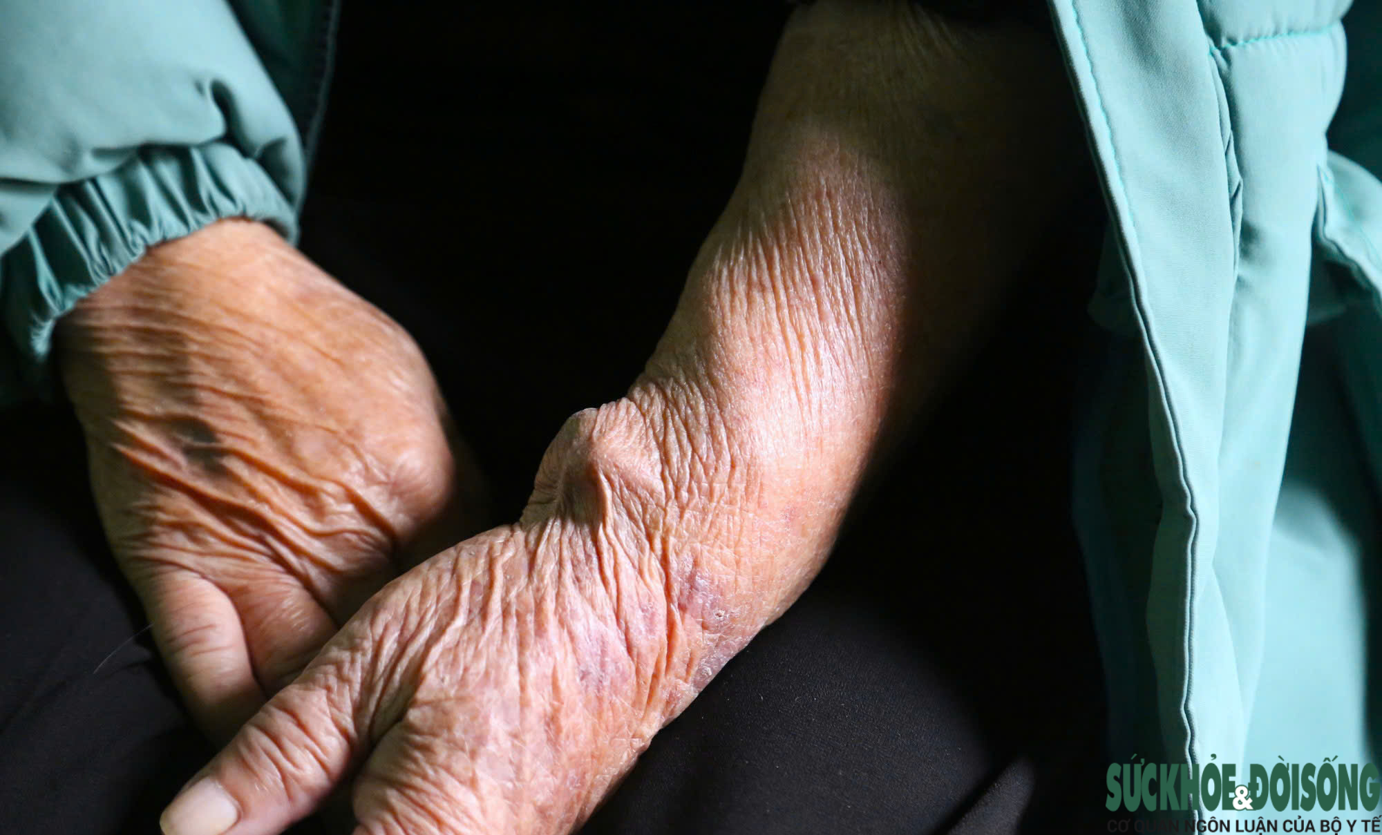 Tết cận kề, những phận người ở 'xóm chạy thận' lặng lẽ níu giữ từng ngày sống- Ảnh 7.