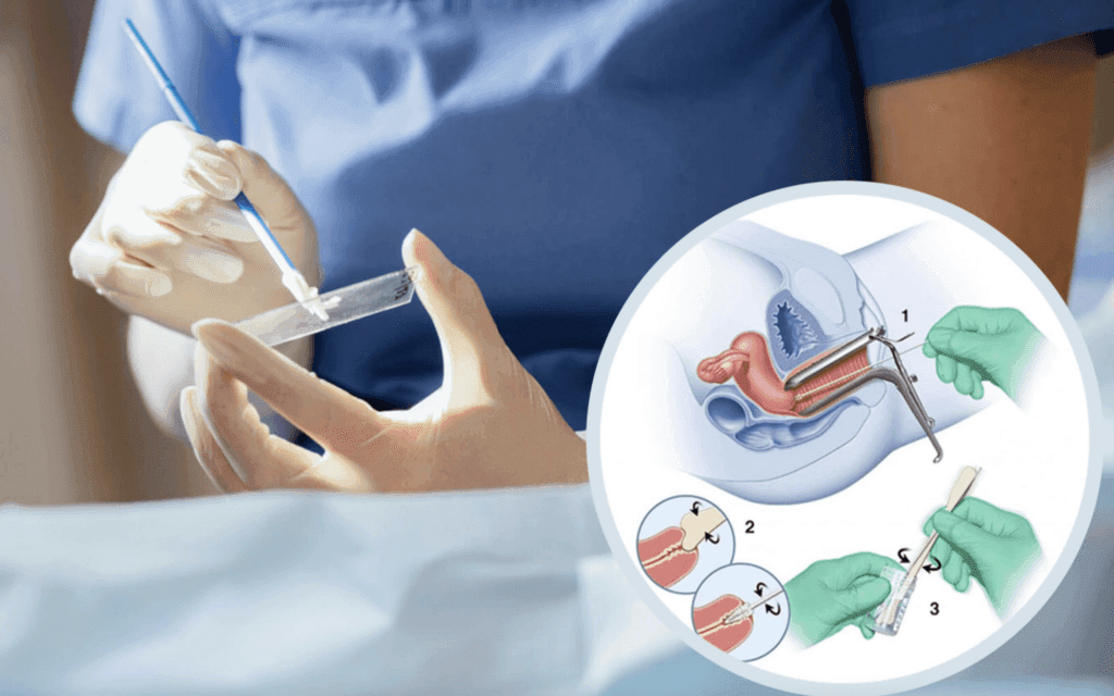 Khi nào nên làm xét nghiệm Pap để sàng lọc ung thư cổ tử cung?