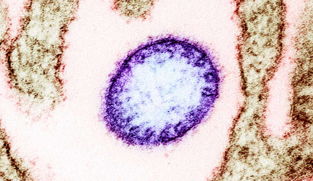 Những rào cản khiến virus Nipah chưa có vaccine- Ảnh 1.