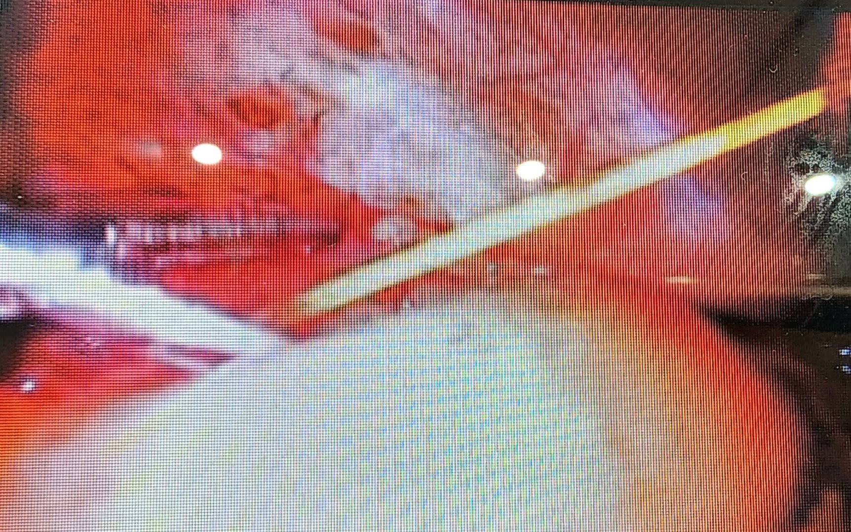 Nuốt tăm không hay biết, người đàn ông 58 tuổi bị thủng đại tràng- Ảnh 2. Nuốt tăm không hay biết, người đàn ông 58 tuổi bị thủng đại tràng- Ảnh 2.