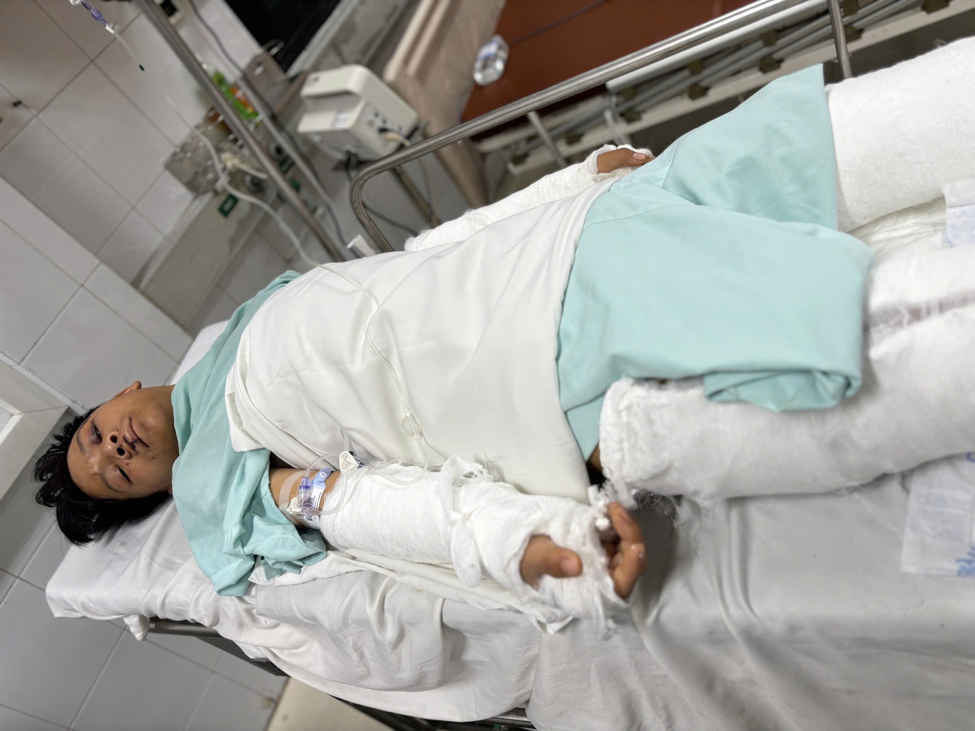 Tai nạn trên đường đến trường và hành trình giành lại sự sống của cậu học trò nghèo dân tộc Dao- Ảnh 1. Tai nạn trên đường đến trường và hành trình giành lại sự sống của cậu học trò nghèo dân tộc Dao- Ảnh 1.