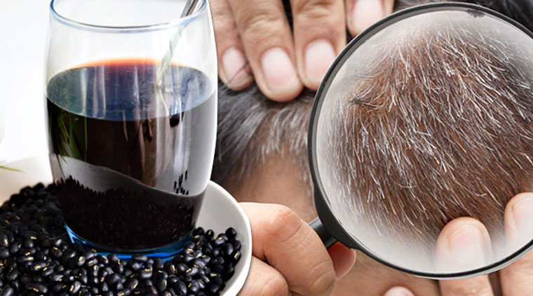 Cách dùng đậu đen chữa bạc tóc sớm đơn giản, dễ làm tại nhà- Ảnh 2.