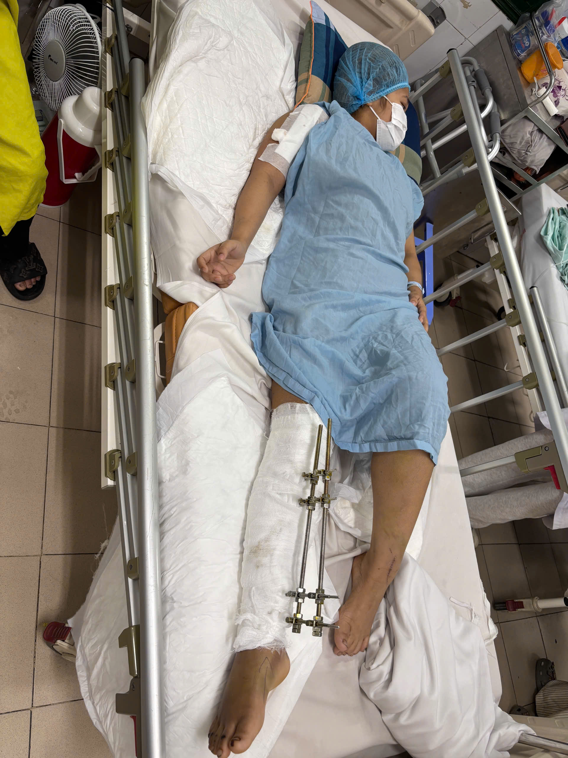 Cảnh khó khăn của cô gái dân tộc Mảng bị tai nạn giao thông cần sự trợ giúp của cộng đồng- Ảnh 1.