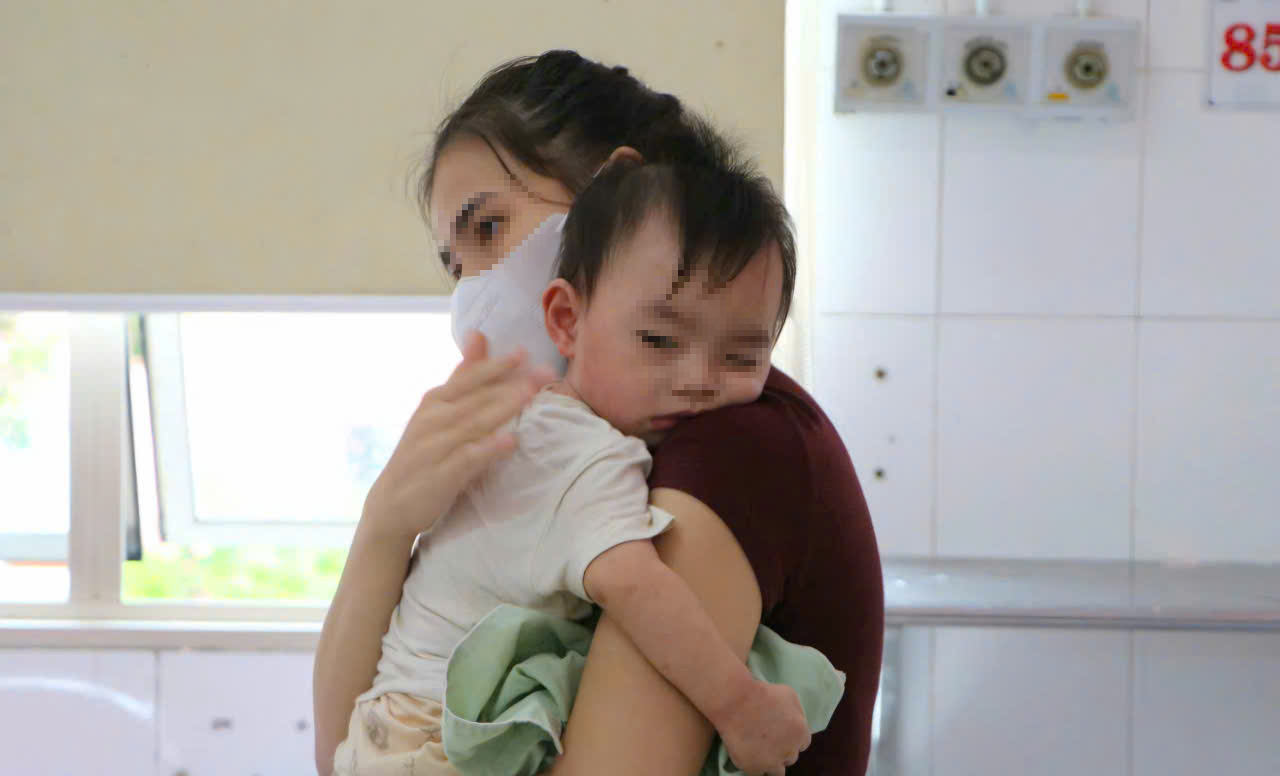 Trẻ mắc bệnh hô hấp ở Huế tăng, khuyến cáo quan trọng phòng bệnh khi giao mùa- Ảnh 2.