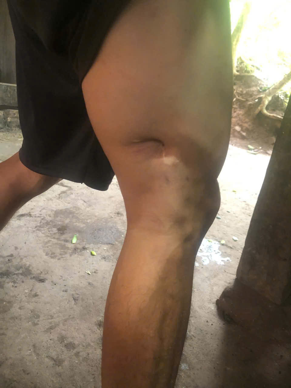 - Ảnh 4.