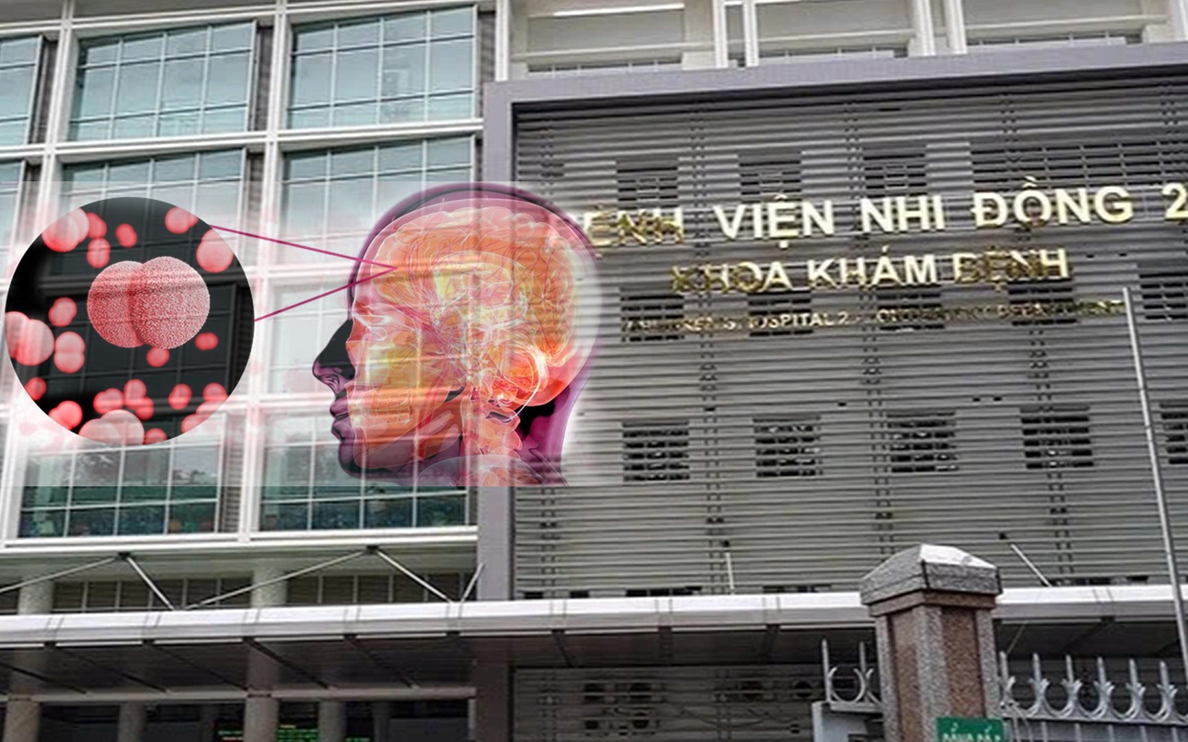 Nhiễm khuẩn do não mô cầu hay gặp trong mùa đông xuân - Ảnh 2.