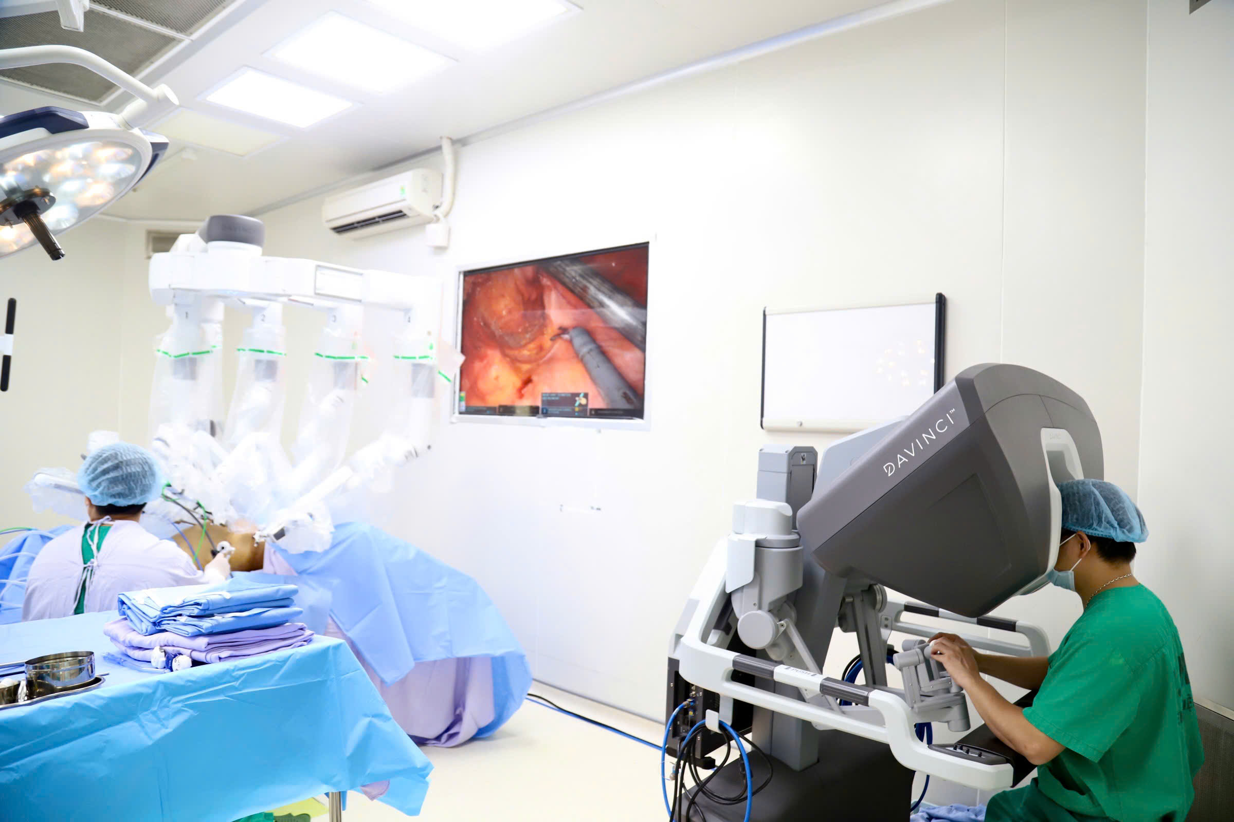 Bệnh viện K ứng dụng robot trong phẫu thuật ung thư trực tràng ở vị trí khó - Ảnh 2.