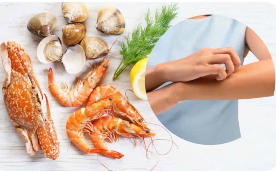 Đêm Giao thừa Tết Bính Ngọ, hơn 115 nghìn người bệnh đang điều trị tại các cơ sở y tế- Ảnh 4. Đêm Giao thừa Tết Bính Ngọ, hơn 115 nghìn người bệnh đang điều trị tại các cơ sở y tế- Ảnh 4.