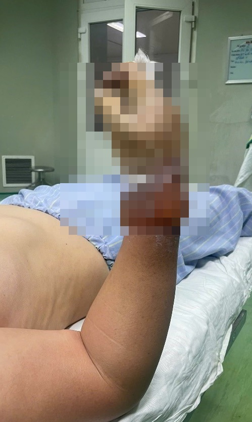 Dựng cây nêu vướng dây điện, người phụ nữ nguy cơ mất cẳng tay- Ảnh 1.