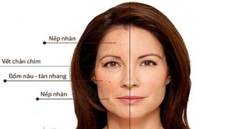 4 bước chăm sóc da tốt nhất duy trì sự trẻ trung cho U40 đón Tết- Ảnh 1.