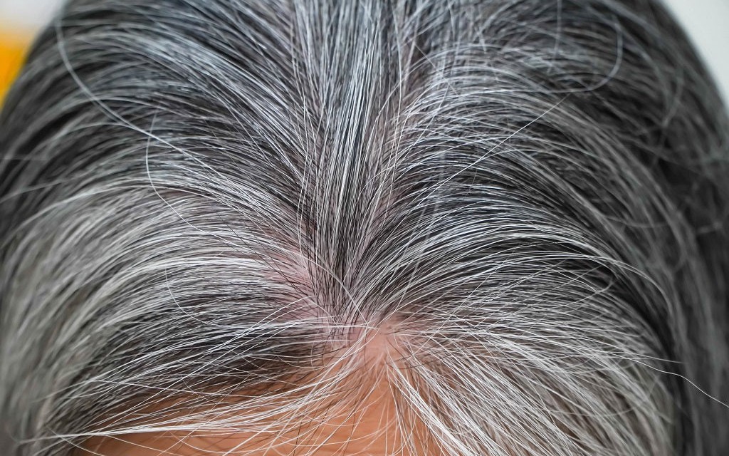 Cách dùng hà thủ ô hỗ trợ ngăn ngừa tóc bạc sớm - Ảnh 3.