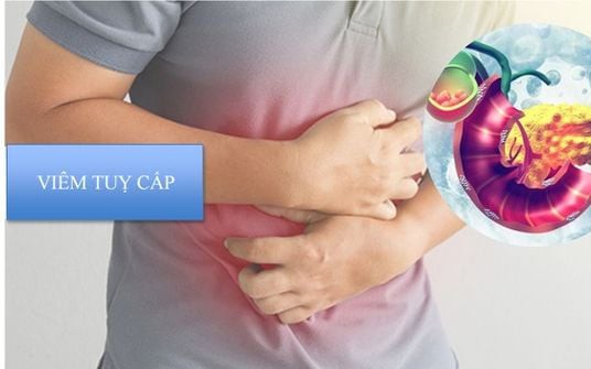 Một người bị tắc mật và viêm tụy cấp do kẹt thức ăn- Ảnh 2. Cảnh giác viêm tụy cấp sau bữa ăn thịnh soạn