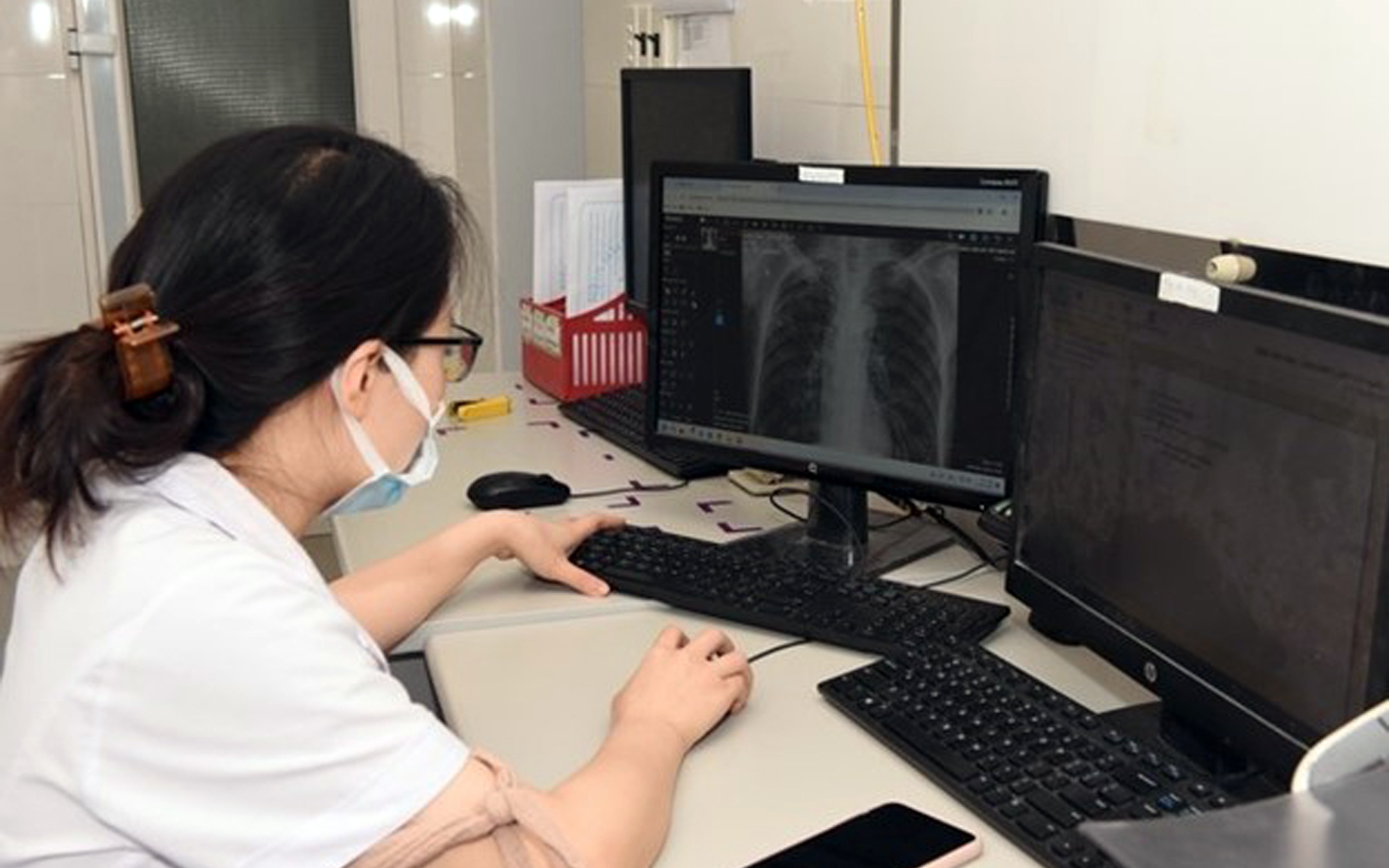 Bộ Y tế đôn đốc khẩn trương phê duyệt giá dịch vụ chẩn đoán hình ảnh sử dụng PACS - Ảnh 3.