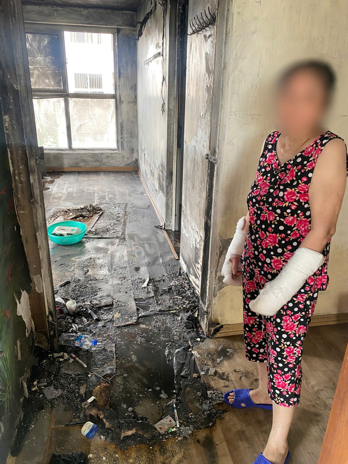 Mâu thuẫn với con dâu, mẹ chồng tẩm xăng đốt căn hộ, hai cháu nội bị bỏng- Ảnh 1.