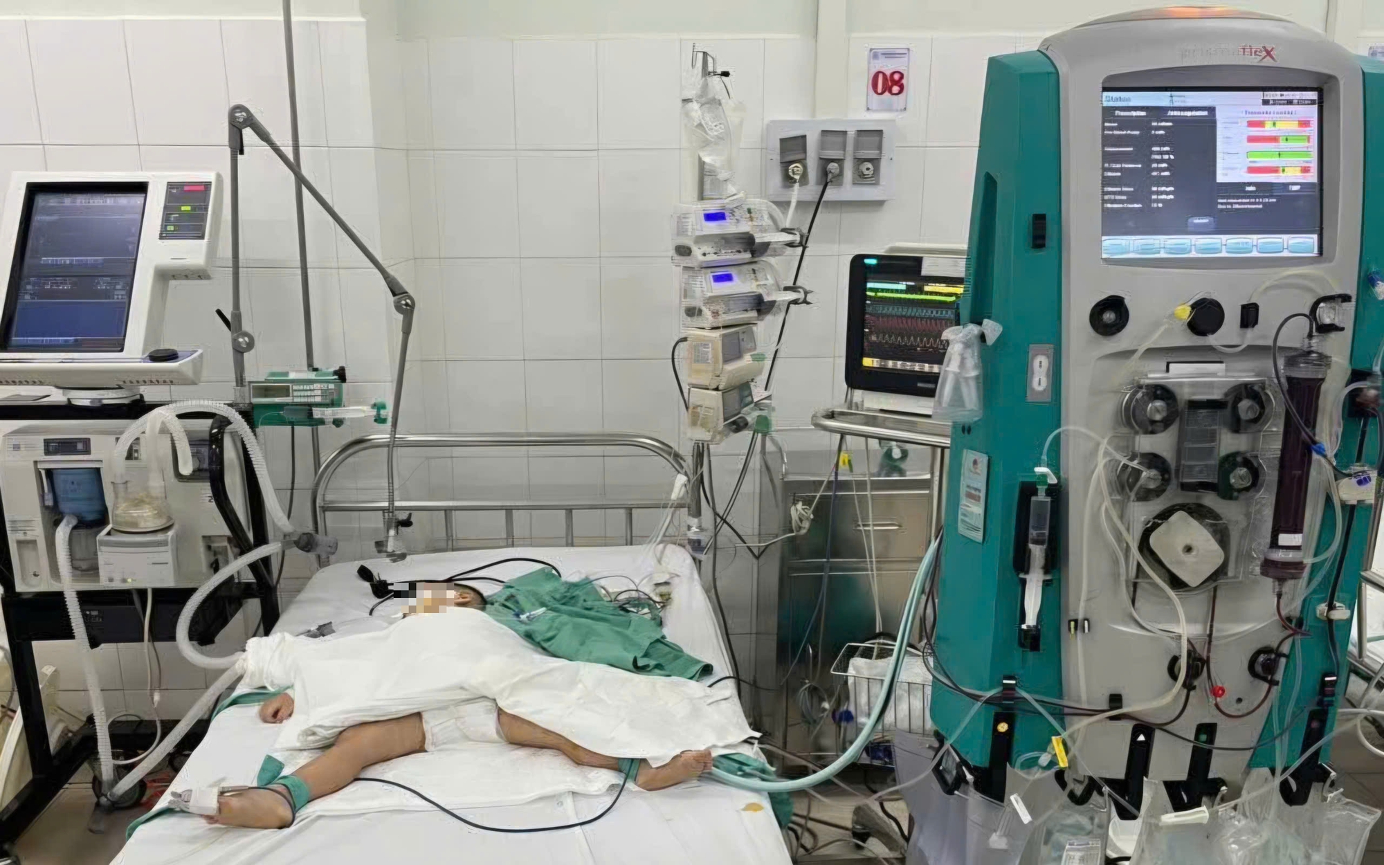 Cứu sống ngoạn mục cháu bé mắc tay chân miệng nguy kịch trong những ngày Tết