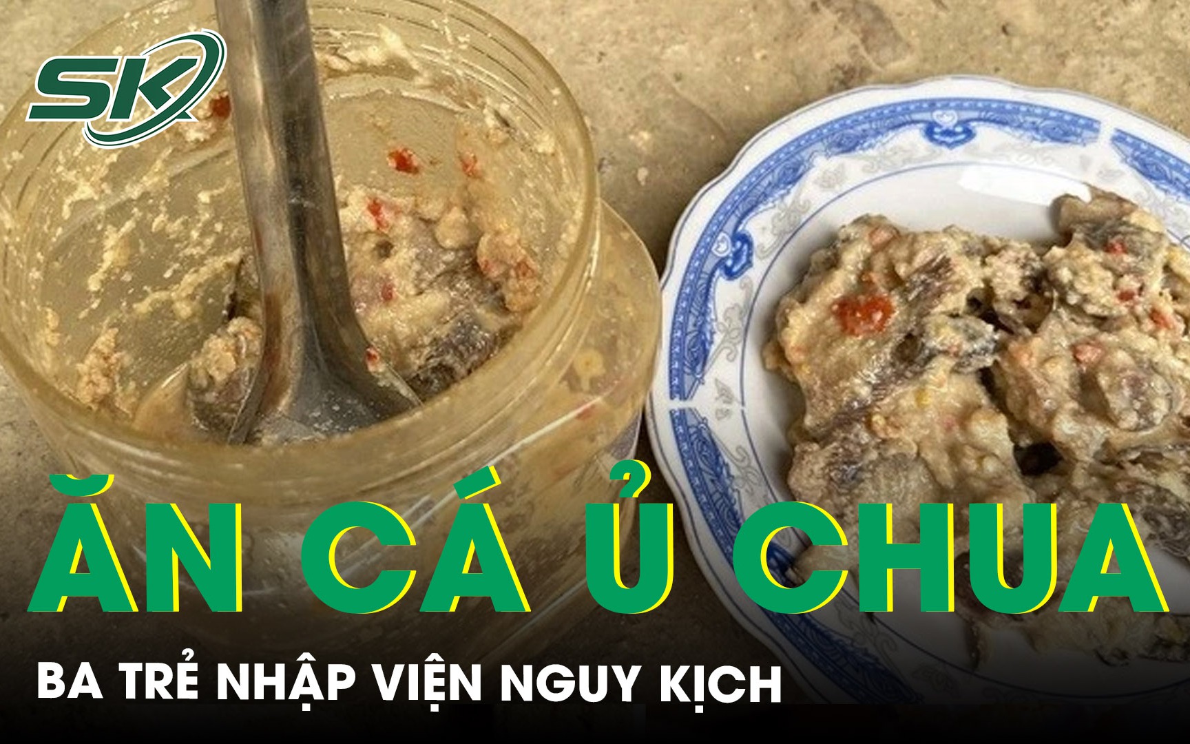 Ba trẻ nhập viện nguy kịch sau bữa cá ủ chua nghi ngộ độc Botulinum