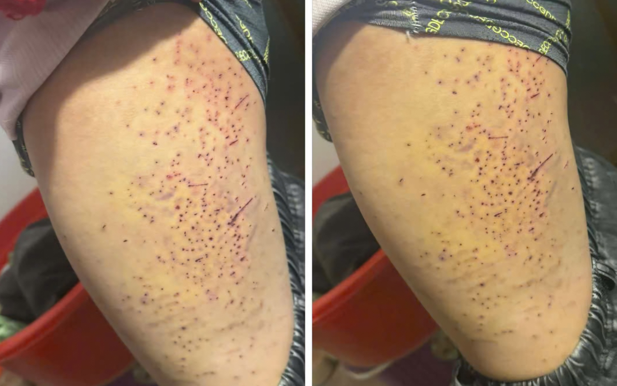 Xác minh thông tin học sinh bị bạn "đâm" gây thương tích ở Lào Cai