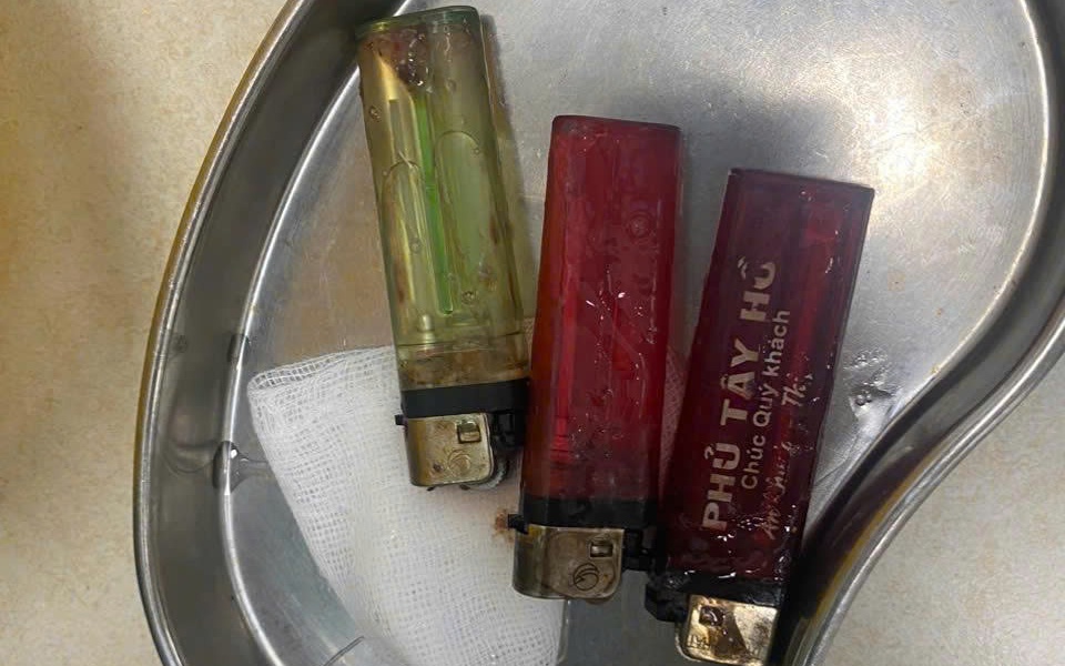 Tưởng đã khỏi viêm gan sau 20 năm, người đàn ông bất ngờ phát hiện ung thư gan di căn- Ảnh 3. Tưởng đã khỏi viêm gan sau 20 năm, người đàn ông bất ngờ phát hiện ung thư gan di căn- Ảnh 3.