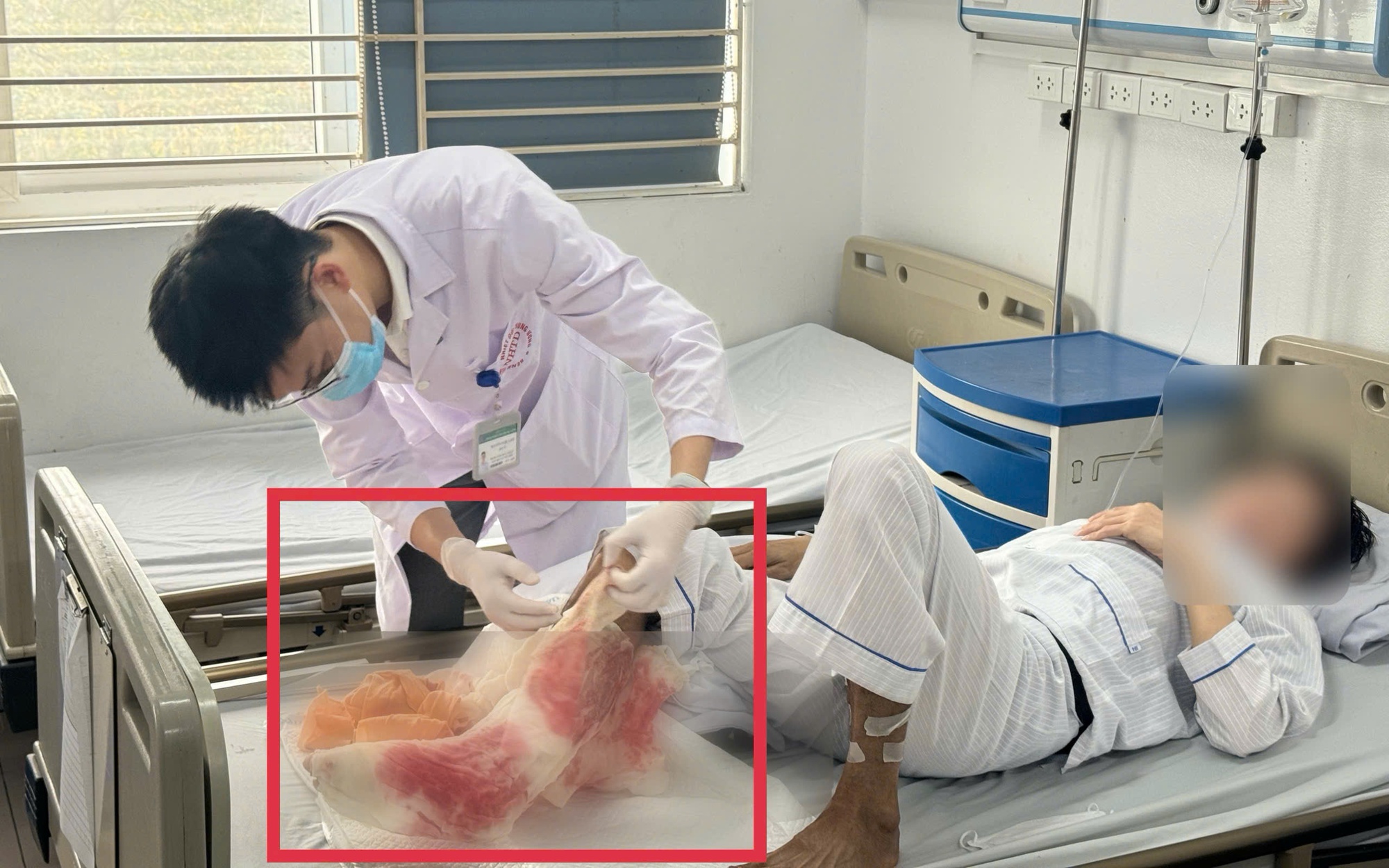 Nuốt vội miếng thịt trong bữa tối, người đàn ông suýt tắc thở- Ảnh 1.