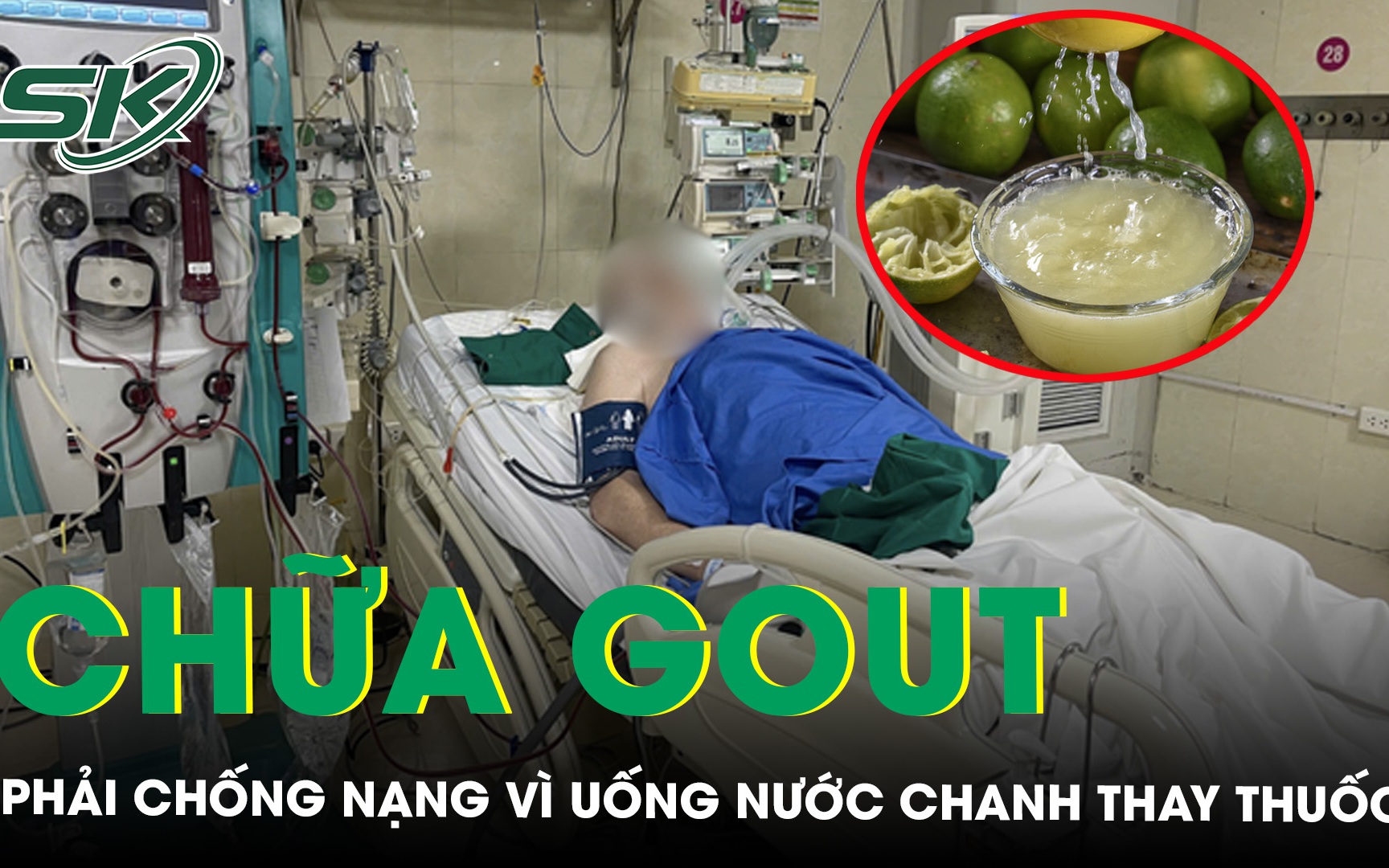 Dùng mẹo dân gian chữa gout, người đàn ông đối mặt nguy cơ tàn phế- Ảnh 3.