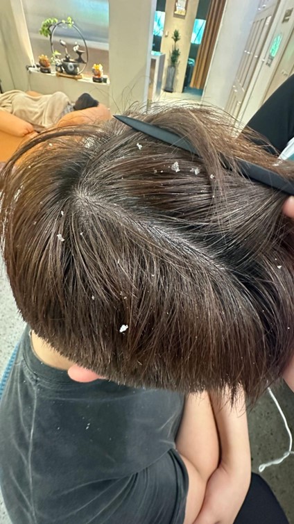 Chăm sóc da đầu khoa học: Vì sao dược liệu trở thành xu hướng trong chuẩn chăm sóc tóc mới- Ảnh 1.