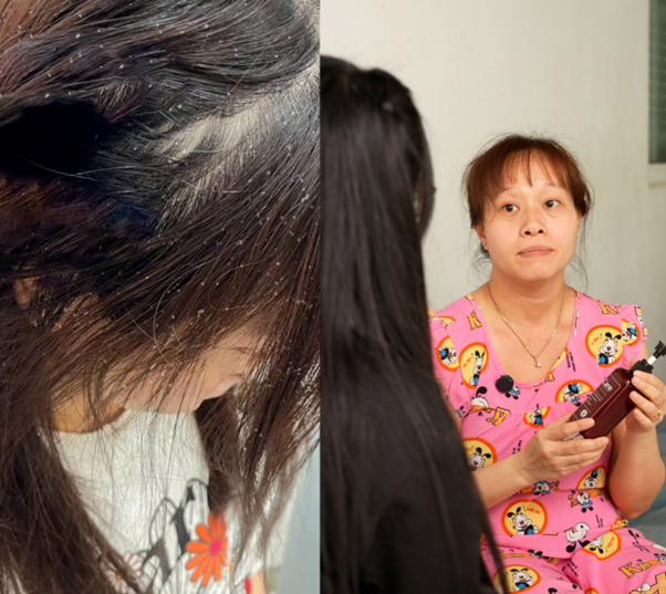 Chăm sóc da đầu khoa học: Vì sao dược liệu trở thành xu hướng trong chuẩn chăm sóc tóc mới- Ảnh 3.