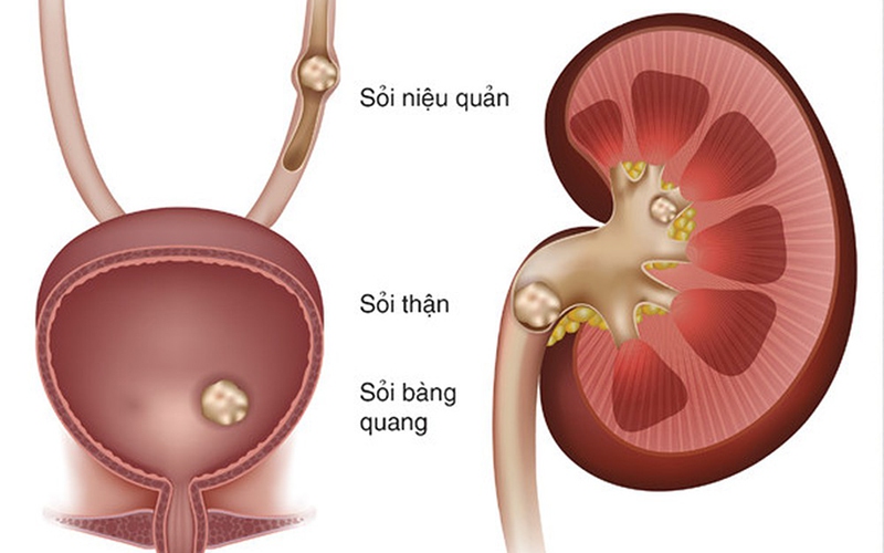 soi nieu quan2 17743478169401765525951 56 0 556 800 crop 1774347916014823934488
